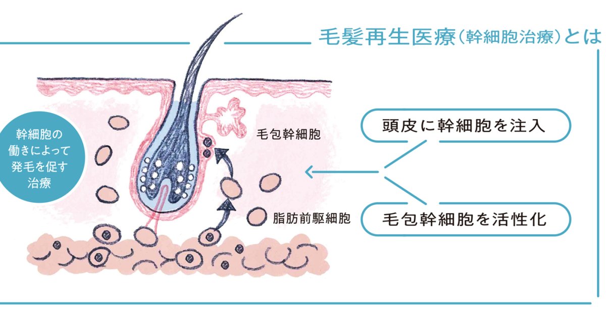 次世代のAGA治療！ 自身の幹細胞を用いた毛髪再生医療とは | GOETHE