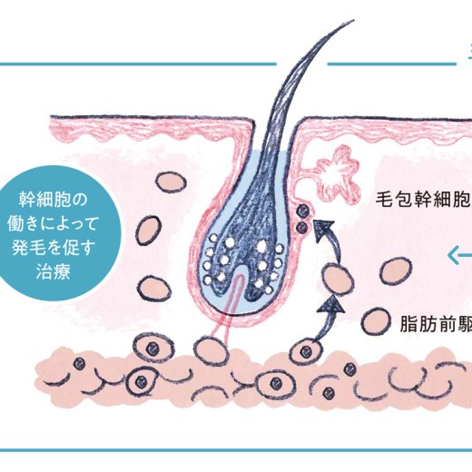 毛髪再生医療とは