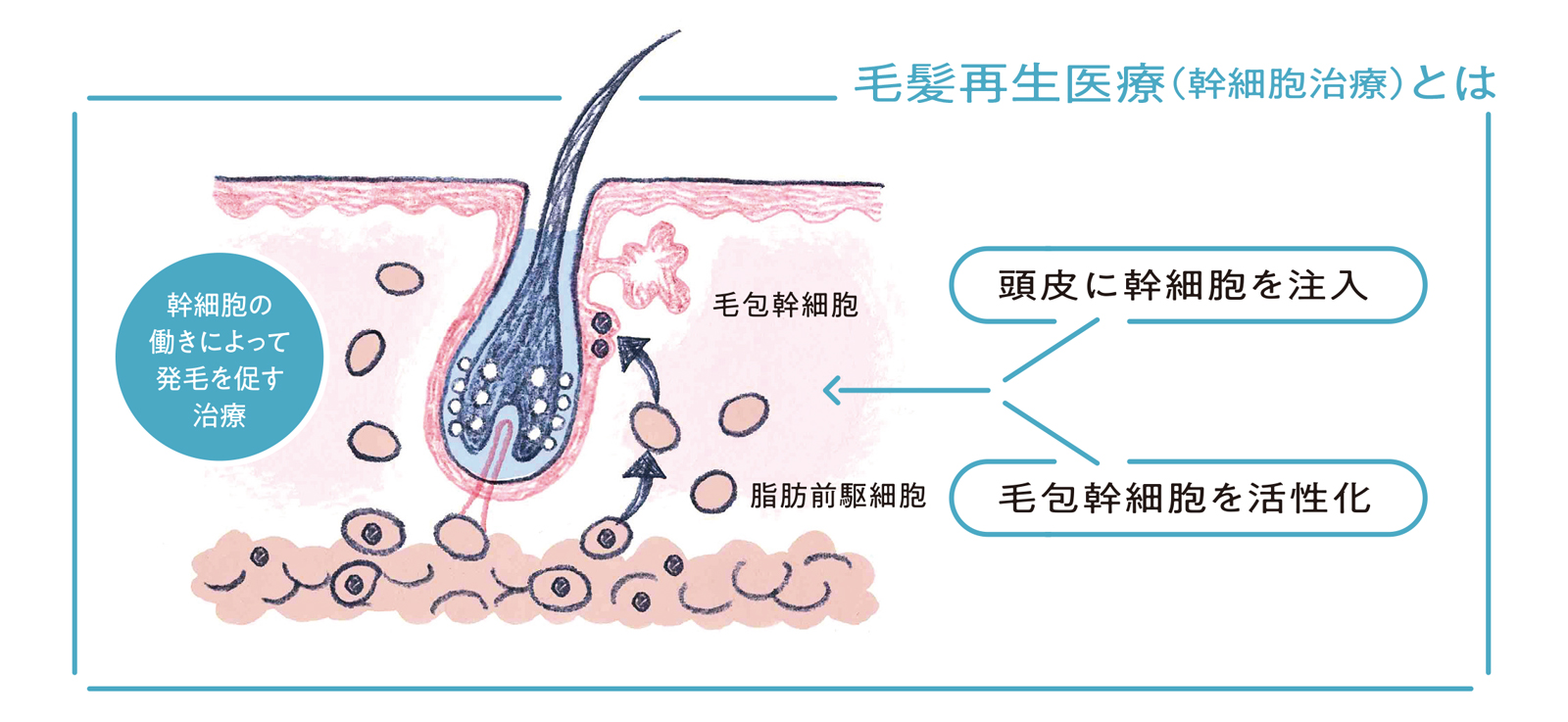 次世代のAGA治療！ 自身の幹細胞を用いた毛髪再生医療とは | GOETHE