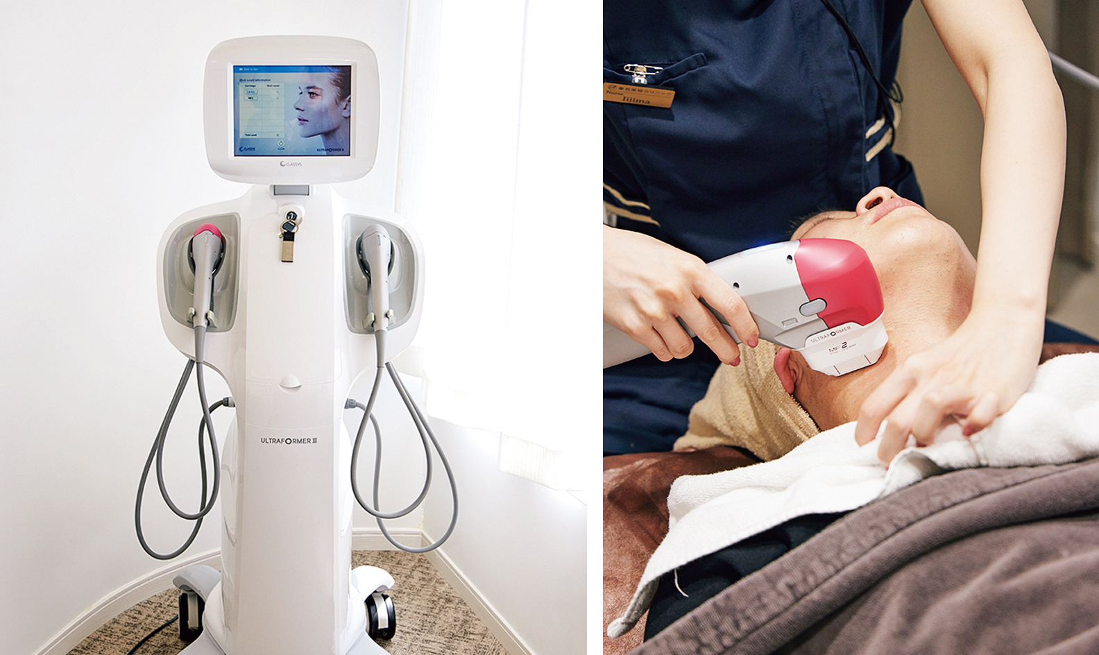 シワ・たるみを撃退！ 今話題の切らないリフトアップ治療“ハイフ”を