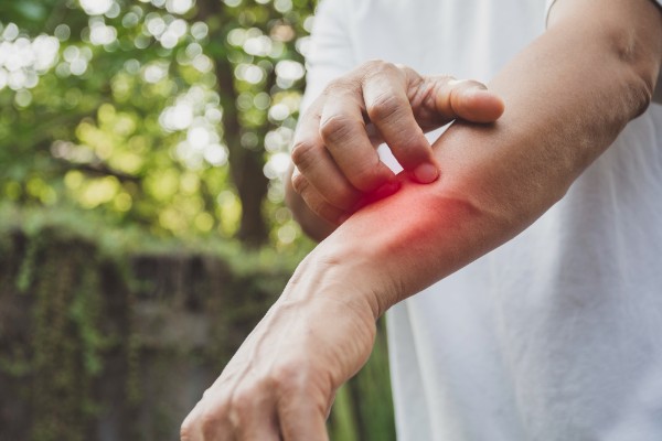 Man scratch itch with hand. Man scratching his